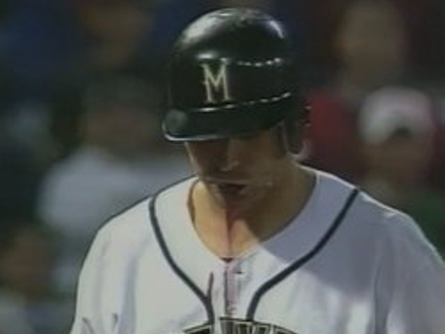 Mike Matheny spits up blood after taking a fastball to the face.