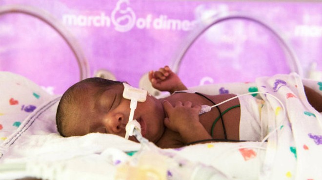 St. Louis received an 'F' on a March of Dimes report card that reviewed premature birth rates nationwide.