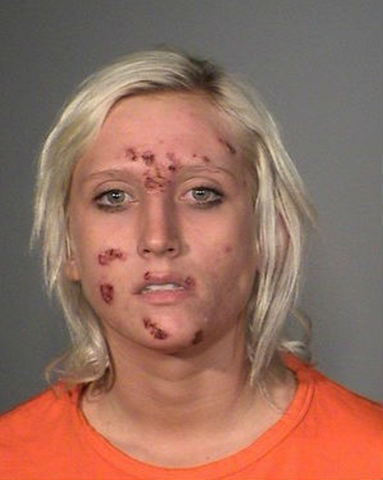 23. Ashley Brooker
When police in Stillwater, Minnesota first encountered her, Ashley Brooker was manically digging through her car in a hospital parking lot, searching for her boyfriend's severed finger. Her face exhibited multiple scars, as if she'd been gnawed on by a famished wolverine who'd just finished a very taxing no-carb diet.
Upon questioning, Brooker remembered that the finger wasn't missing after all; she'd just delivered her boyfriend to the hospital for a minor injury. Nor had she been assaulted by a dieting wolverine. Her facial wounds had magically arrived during a six-day meth bender. But her conspicuous parking lot search did lead the cops to bust her boyfriend for possession.