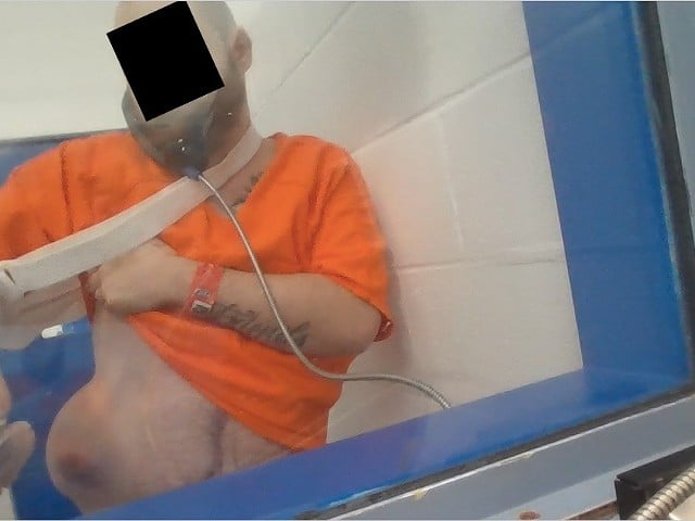 A CJC detainee shows a large hernia that his family says went long-untreated in the jail.