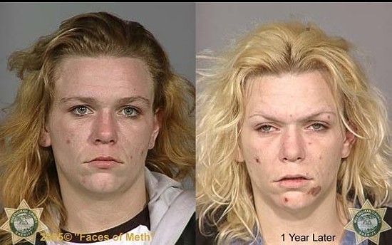 Are side by side photos like these an exaggeration? - FACESOFMETH.US