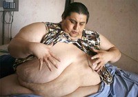 Jon Brower Minnoch: The world's fattest human -- so far