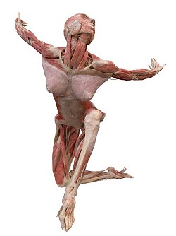 The lawsuit conjures up images of a "Body Worlds" exhibit.