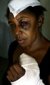 Vigilante Savagery: Woman Beat With Baseball Bat by Relative of Hit-and-Run Victim