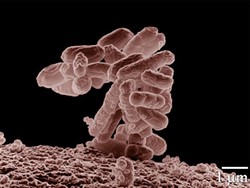E. coli, magnified. - Image via