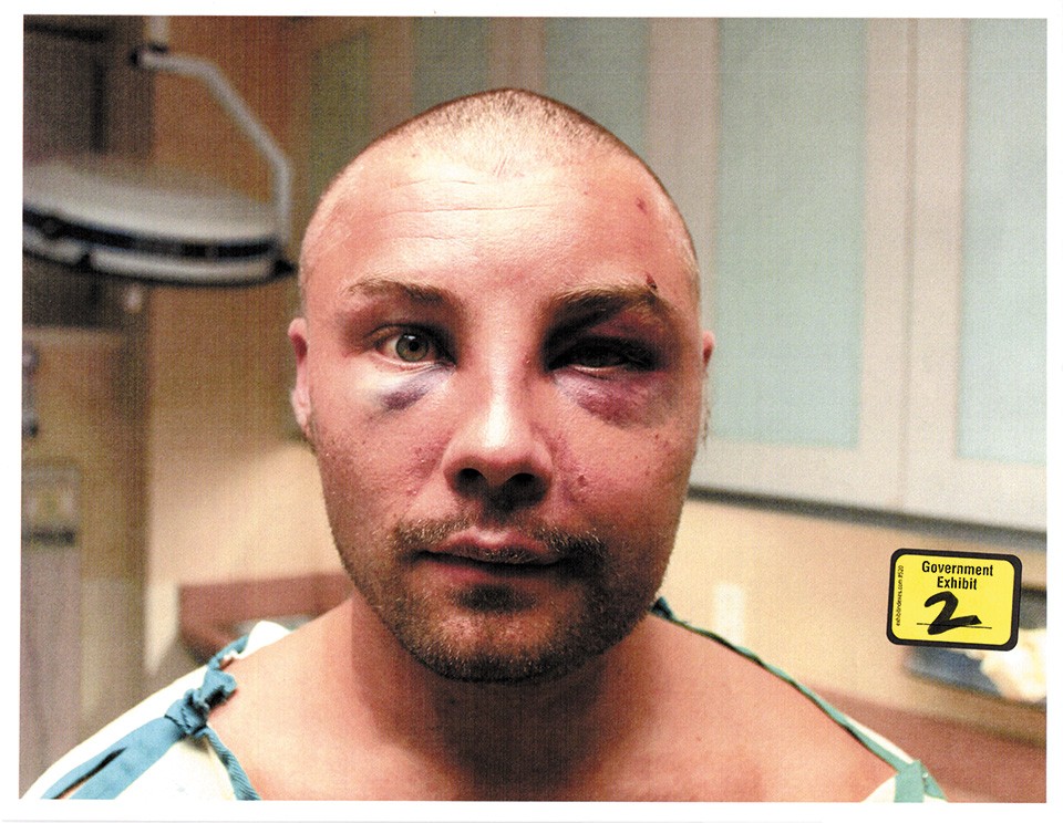 Taken at the hospital, police photos of Ellis Athanas III show his injuries. - COURT FILES