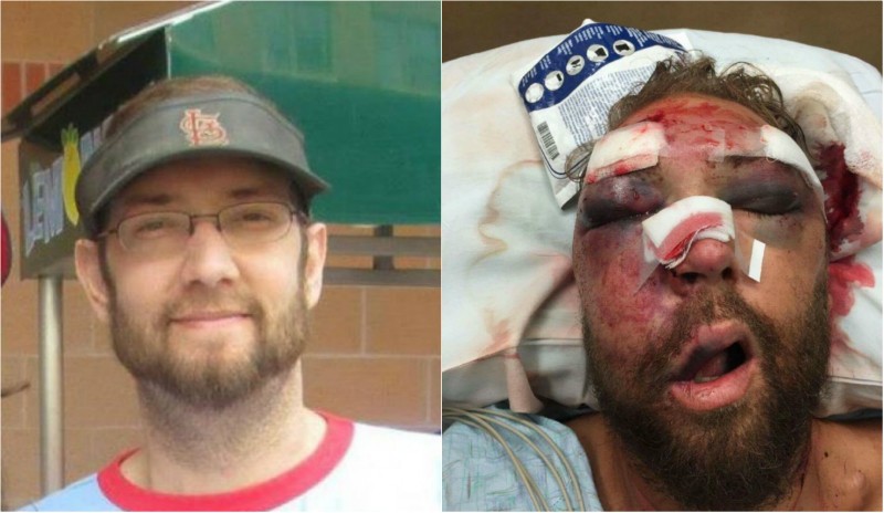 Rob Ludwig, left, before the attack, and after (right). - PHOTOS COURTESY OF ROB LUDWIG