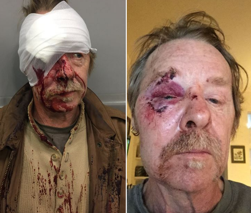 St. Louis Musician Attacked in "Knockout Game" Assault Says He's "Not Angry at Them"